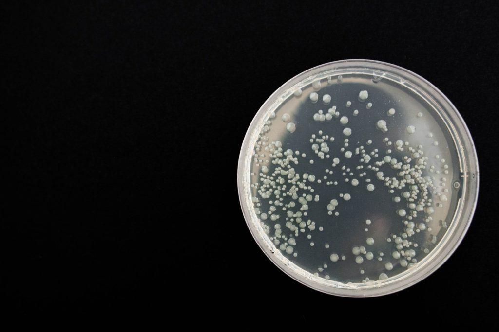 Baktériumok és gombák ellen találtak új baktériumtörzset a Szegedi Tudományegyetem kutatói (Fotó: Pixabay, nadya_il)