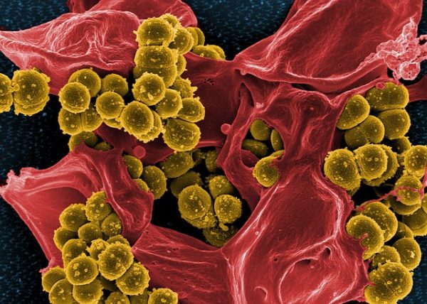 1800 hasznos baktériumtörzset tett elérhetővé a Danone kutatási célokra - képünk illusztráció