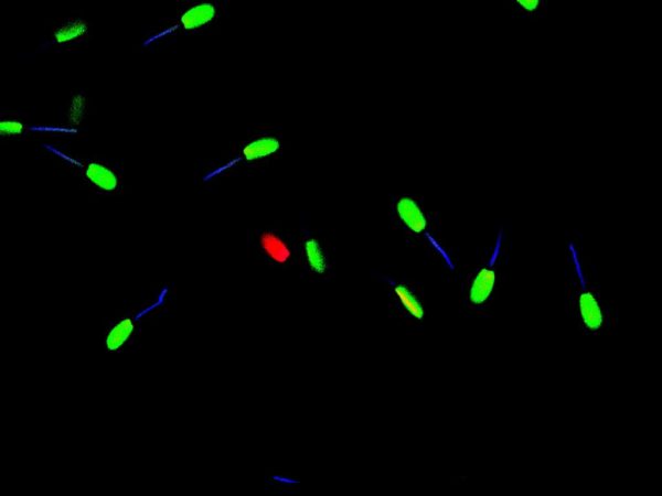 Fluoreszcens spermafestés - élő sejtek zöld, az elhaltak vörös, a mitokondriumok pedig kék színnel jelölve láthatóak.