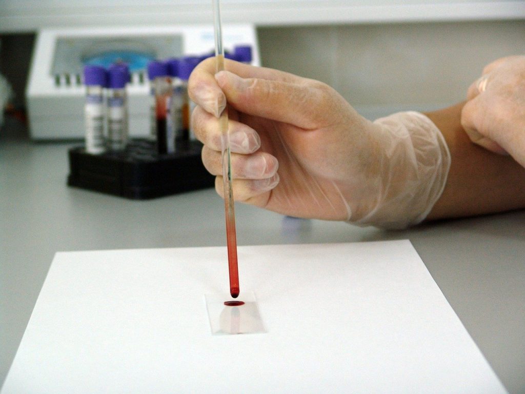 A DBS-technikával könnyebben és kevésbé invazív módon lehet mintát venni az állatokból, mivel csak egy csepp vérre van szükség az állat véréből